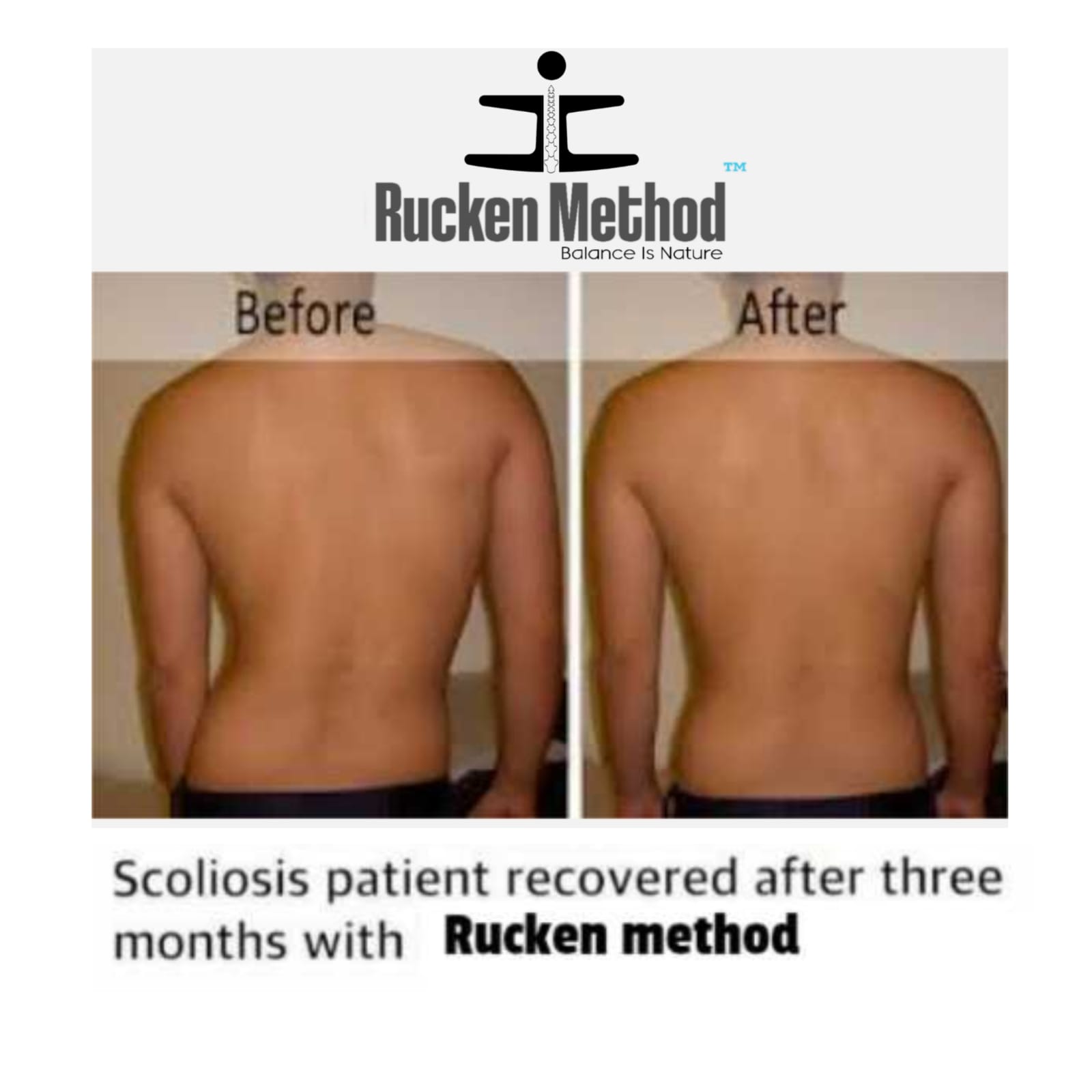 Case 03 Study by Rucken Method